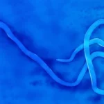 Ebola